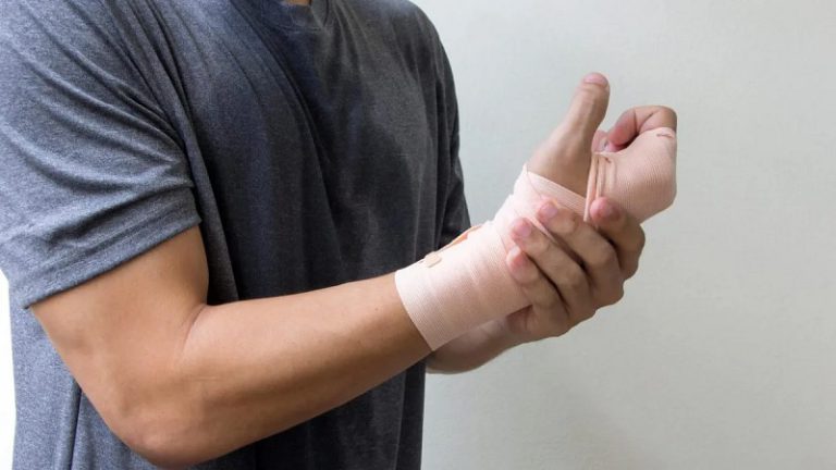How to Treat a Broken Wrist