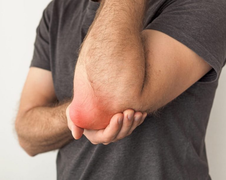 Symptoms and Treatment For Gout Elbow Bursitis