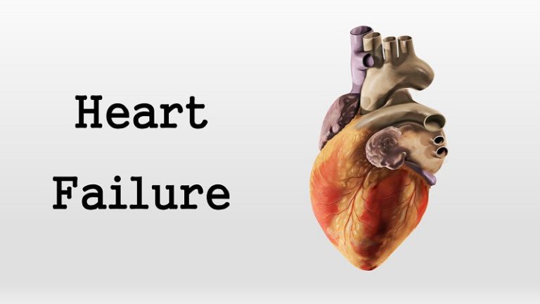 Heart Failure Tests and Diagnosis