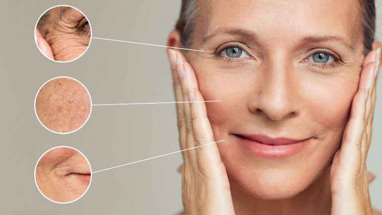 How to Get Rid of Wrinkles Permanently